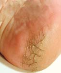 Foot Dr. フットスパ・システム 角質キレイに