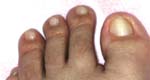 Foot Dr. フットスパ・システム 角質キレイに