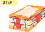 LEOREX�@���I���b�N�X�Estep1