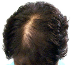 Rich up hair�i���b�`�A�b�v�w�A�[�j�g�p�O