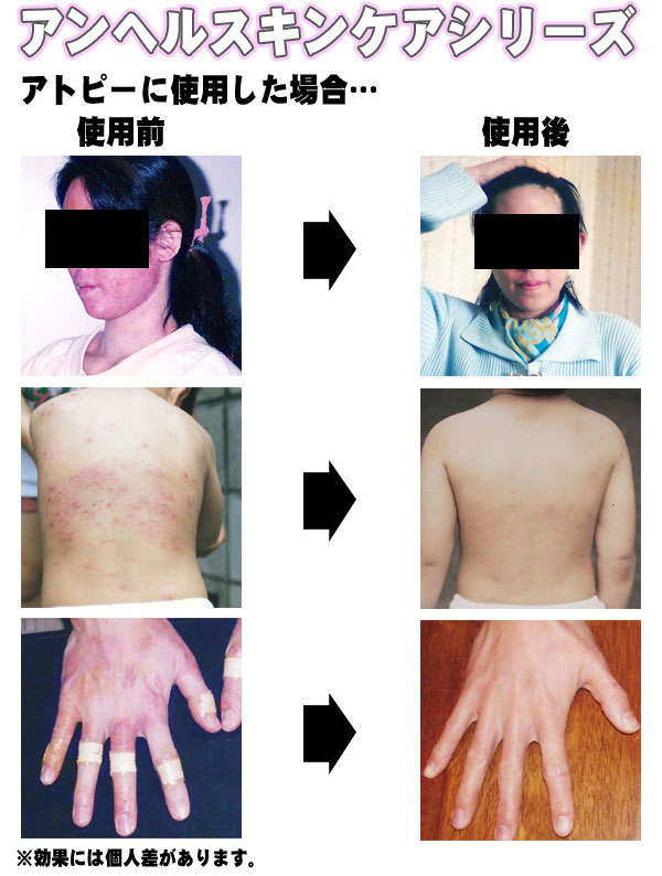 �V�g�̑��蕨 �A���w���X�L���P�A�V���[�Y �g�p���ʔ�r