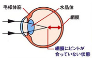 �����g���Ê�A�C�p���[�E�ߎ��̏��