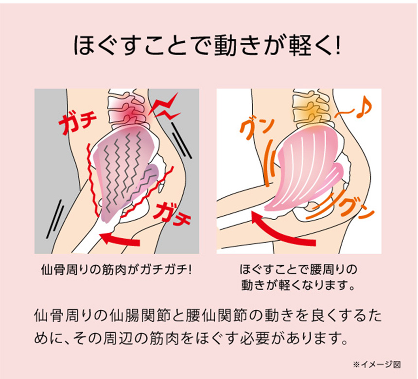 コシレッチ